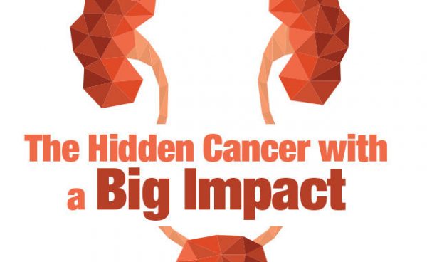 Bladder Cancer Is The Hidden Cancer With A Big Impact